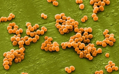 Phát hiện thực phẩm chay nhiễm độc tố tụ cầu vàng